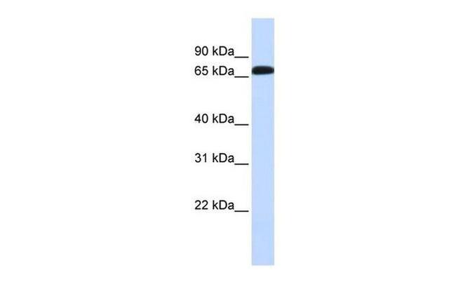 SLC6A1 Antibody in Western Blot (WB)