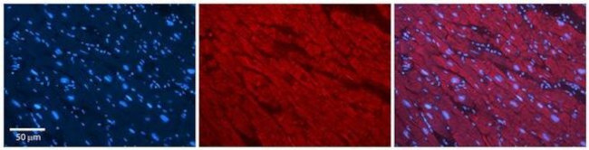 SLC25A12 Antibody in Immunohistochemistry (Paraffin) (IHC (P))