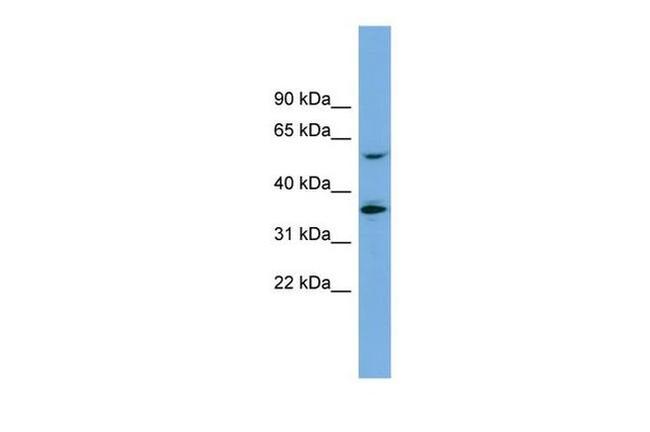 SLC7A7 Antibody in Western Blot (WB)