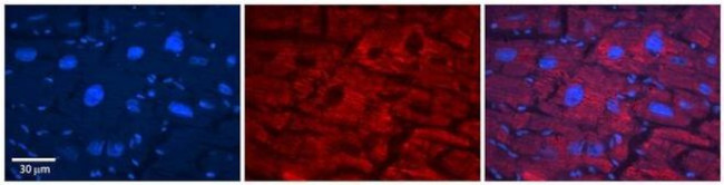 SLC33A1 Antibody in Immunohistochemistry (Paraffin) (IHC (P))