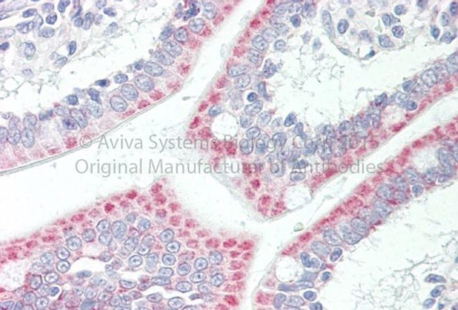 SLC33A1 Antibody in Immunohistochemistry (Paraffin) (IHC (P))