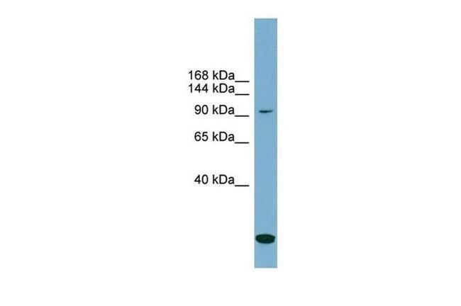 KCC1 Antibody in Western Blot (WB)