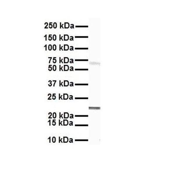 SLC27A4 Antibody in Western Blot (WB)