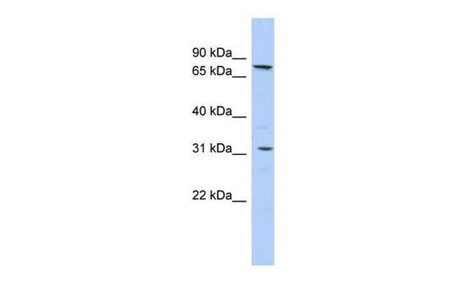 SLC23A2 Antibody in Western Blot (WB)