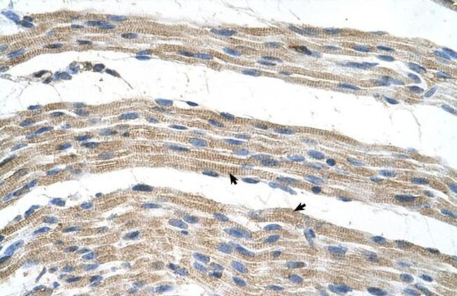 SLC17A4 Antibody in Immunohistochemistry (IHC)