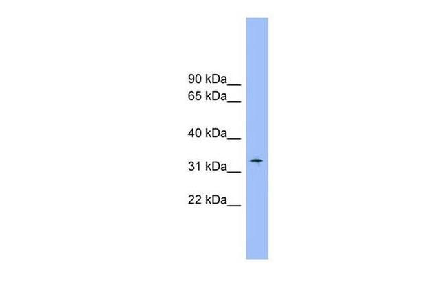 SLC25A1 Antibody in Western Blot (WB)