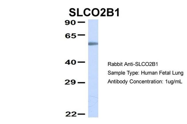 SLCO2B1 Antibody in Western Blot (WB)