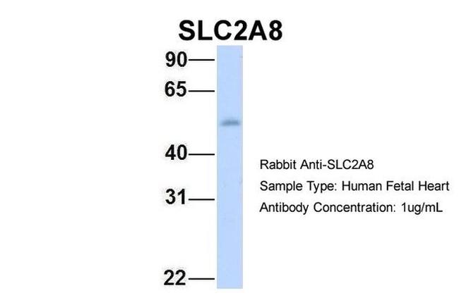 SLC2A8 Antibody in Western Blot (WB)