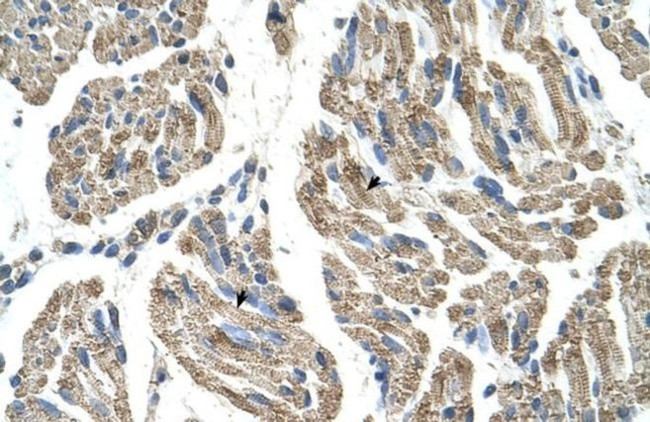 SLC25A38 Antibody in Immunohistochemistry (IHC)