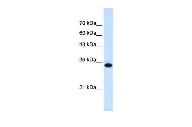 SLC25A38 Antibody in Western Blot (WB)