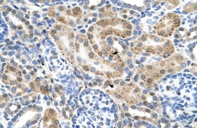 SLC22A3 Antibody in Immunohistochemistry (IHC)