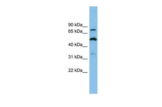 SLC26A1 Antibody in Western Blot (WB)