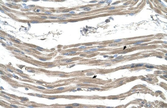 SLC25A22 Antibody in Immunohistochemistry (IHC)