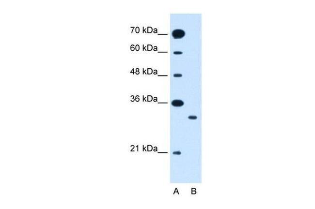 SLC25A22 Antibody in Western Blot (WB)