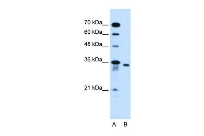 SLC25A32 Antibody in Western Blot (WB)