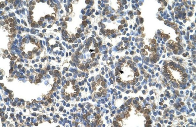 SLC37A3 Antibody in Immunohistochemistry (IHC)