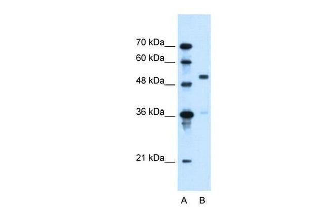 SLC37A3 Antibody in Western Blot (WB)