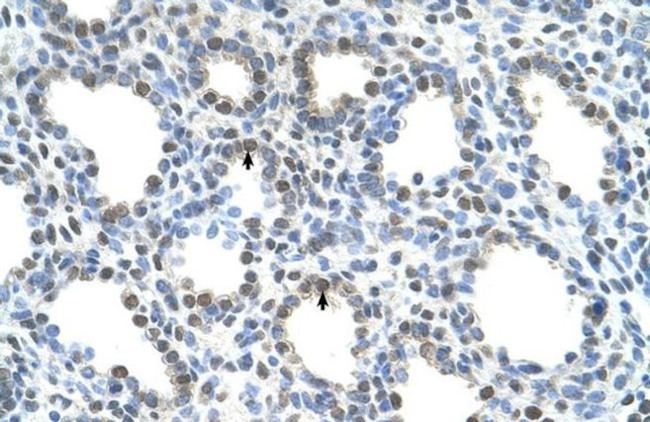 SLC15A4 Antibody in Immunohistochemistry (IHC)