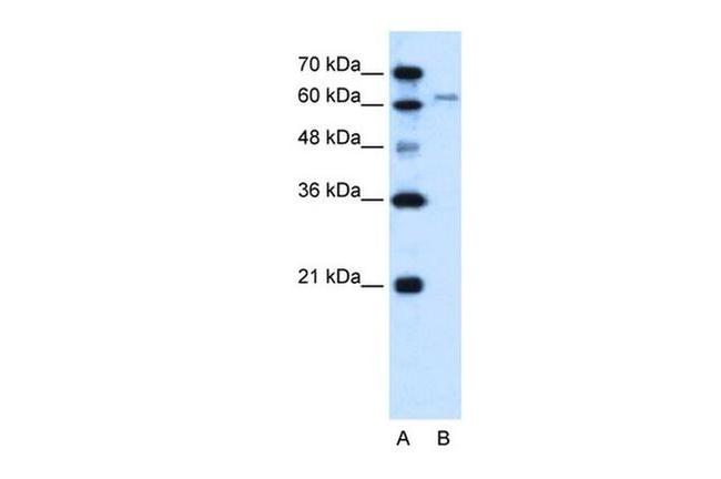 SLC15A4 Antibody in Western Blot (WB)