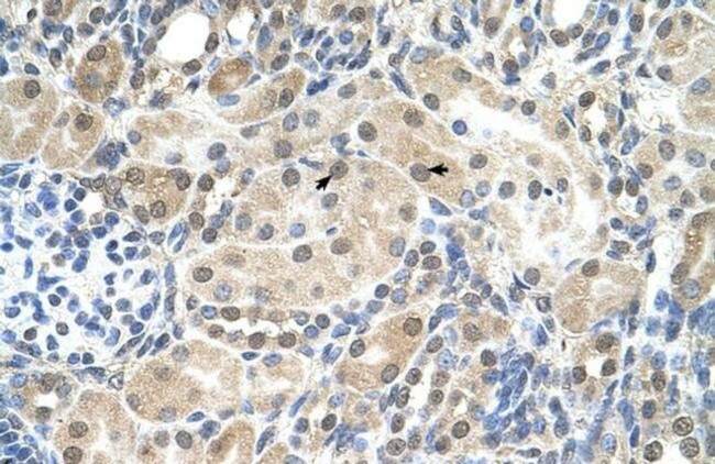 SLC9A9 Antibody in Immunohistochemistry (IHC)