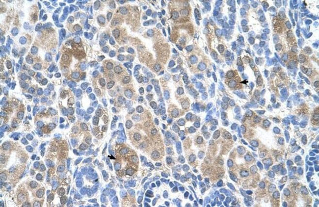 SLC36A3 Antibody in Immunohistochemistry (IHC)