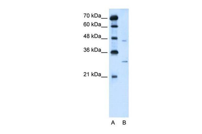 SLC36A3 Antibody in Western Blot (WB)