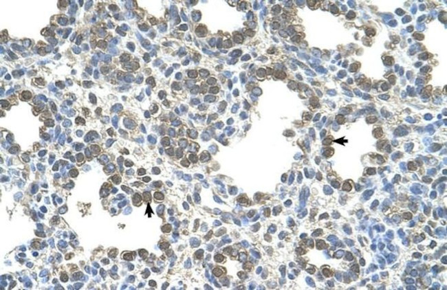 SLC26A5 Antibody in Immunohistochemistry (IHC)