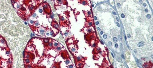 G6PC Antibody in Immunohistochemistry (IHC)