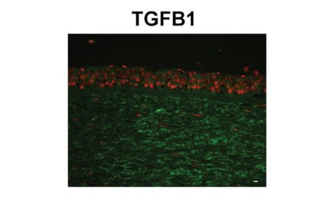 TGFBI Antibody in Immunohistochemistry (IHC)