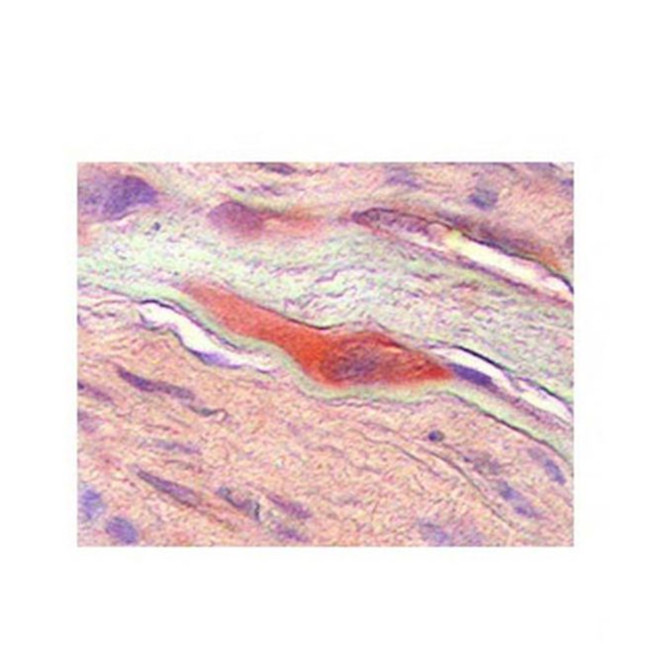 M-CSF Antibody in Immunohistochemistry (IHC)