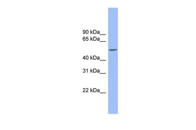 M-CSF Antibody in Western Blot (WB)