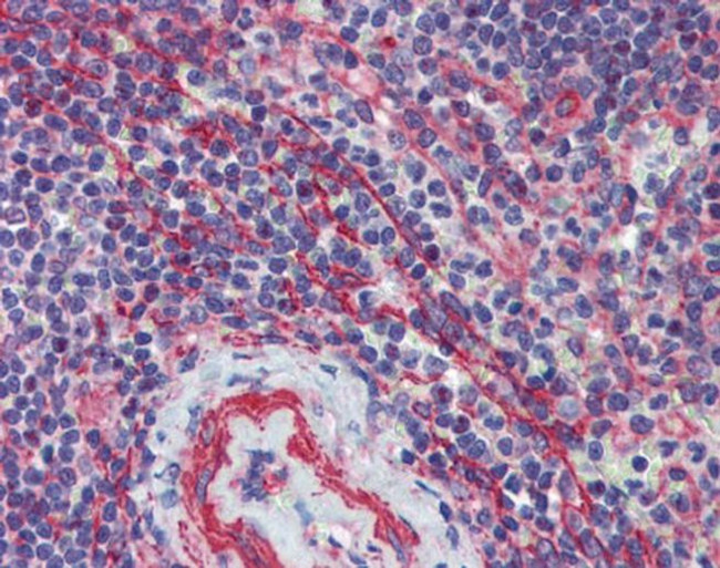 MCTP1 Antibody in Immunohistochemistry (Paraffin) (IHC (P))