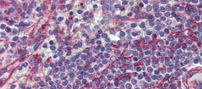 MCTP1 Antibody in Immunohistochemistry (Paraffin) (IHC (P))