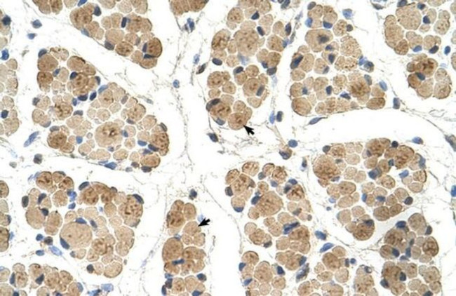 KLHL31 Antibody in Immunohistochemistry (IHC)