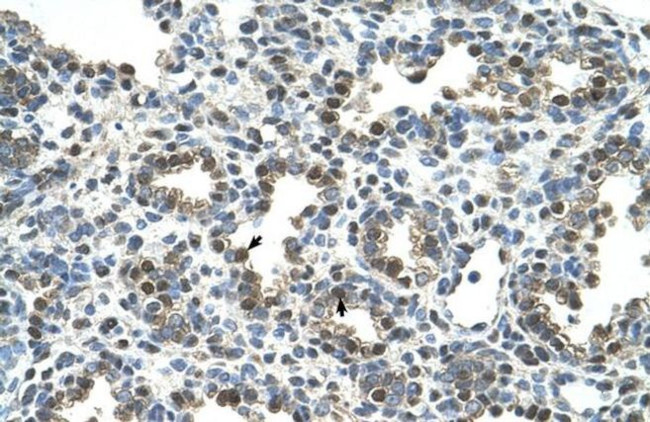 GPNMB Antibody in Immunohistochemistry (IHC)