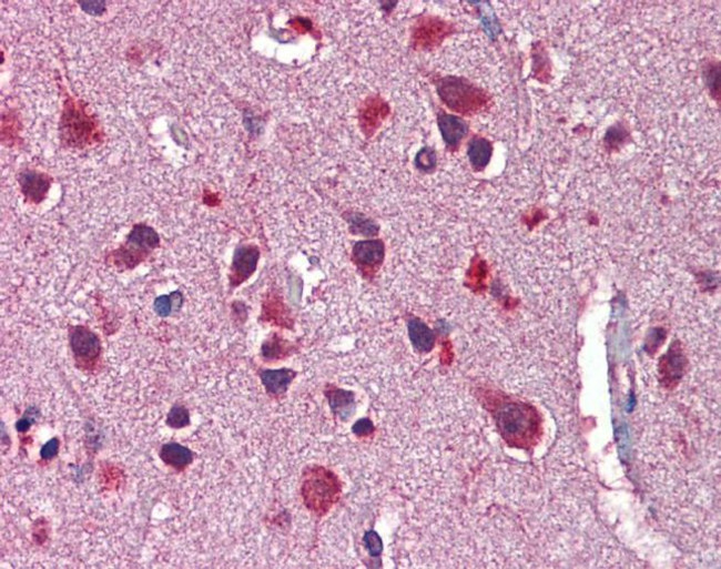 NRG3 Antibody in Immunohistochemistry (IHC)