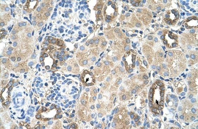 MGAT2 Antibody in Immunohistochemistry (IHC)