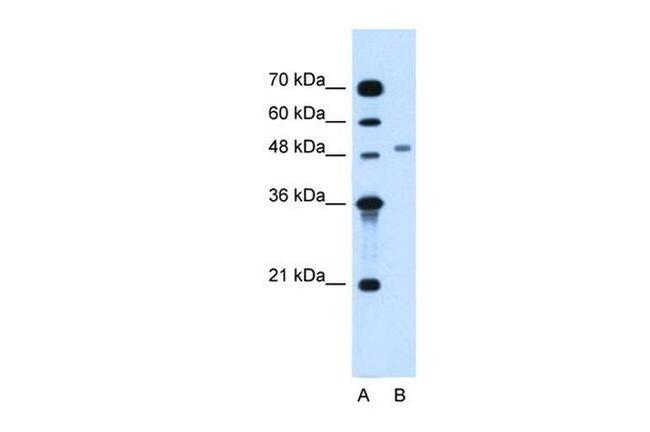 MGAT2 Antibody in Western Blot (WB)