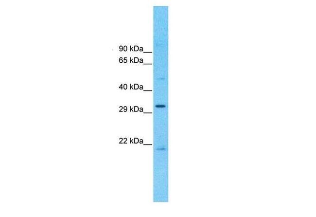 CCDC90A Antibody in Western Blot (WB)