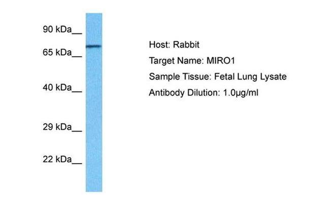 RHOT1 Antibody in Western Blot (WB)