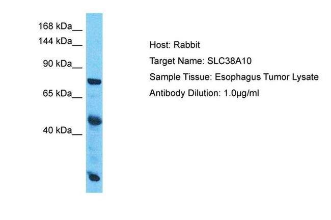 SLC38A10 Antibody in Western Blot (WB)