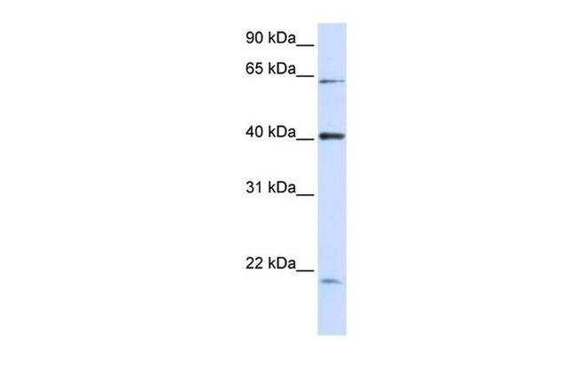 SYNE4 Antibody in Western Blot (WB)