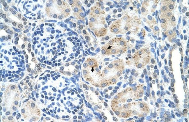 SPPL2B Antibody in Immunohistochemistry (IHC)