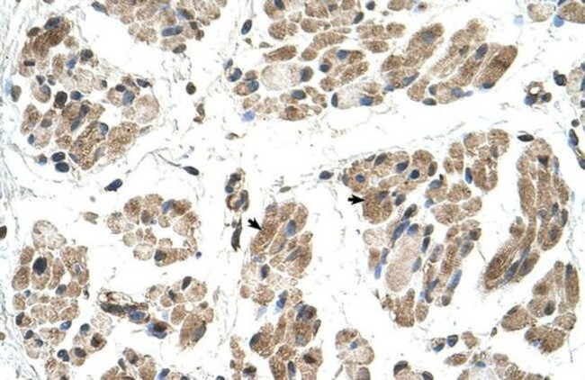 FKTN Antibody in Immunohistochemistry (IHC)