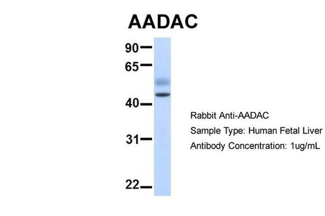 AADAC Antibody in Western Blot (WB)