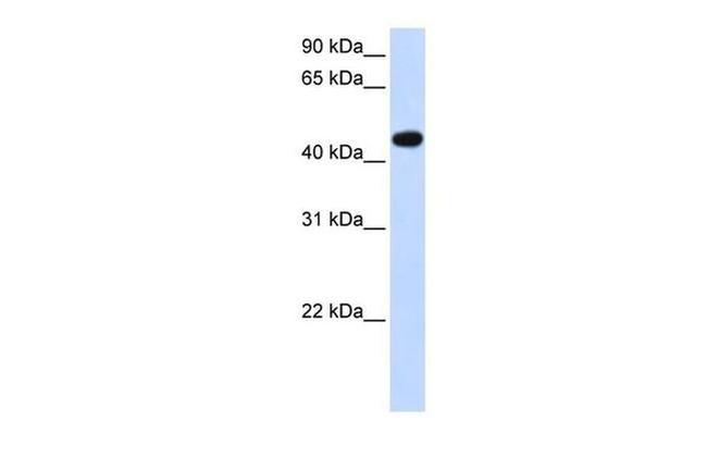 AADAC Antibody in Western Blot (WB)