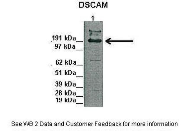 DSCAM Antibody in Western Blot (WB)