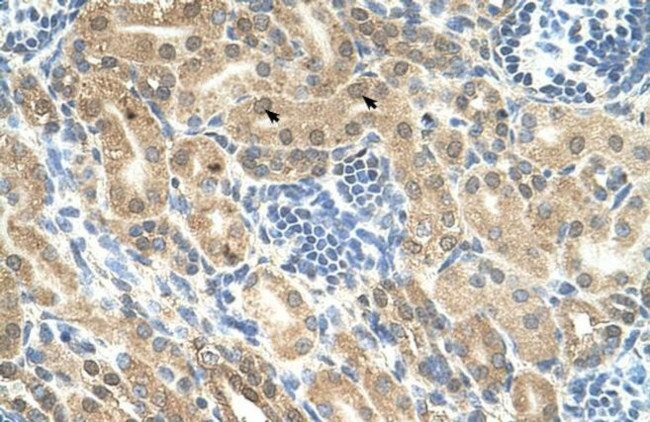 IHH Antibody in Immunohistochemistry (IHC)