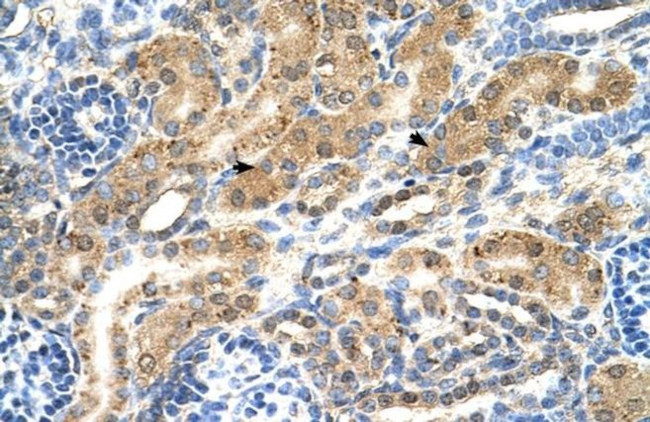 PTPN2 Antibody in Immunohistochemistry (IHC)