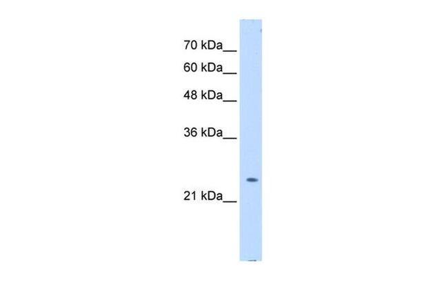 PTPN2 Antibody in Western Blot (WB)